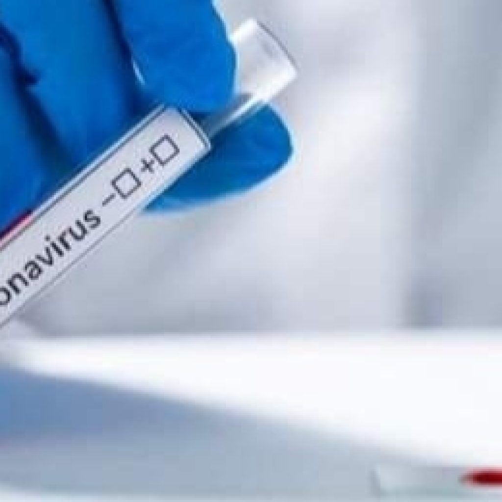 Rapid Tes Pesanan Pemda Kolaka Belum Tiba