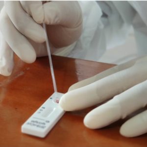 Satu Anak di Kolaka Terkonfirmasi Positif Covid-19